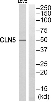CLN5 rabbit pAb