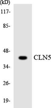 CLN5 rabbit pAb