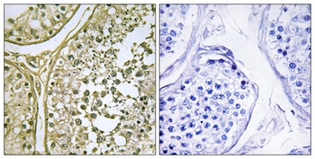 Casein Kinase I α1/1L rabbit pAb