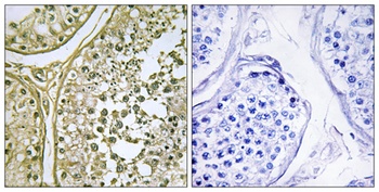 Casein Kinase I alpha1/1L antibody