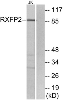 Relaxin Receptor 2 antibody
