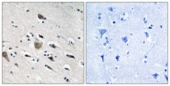 MRP-L52 antibody