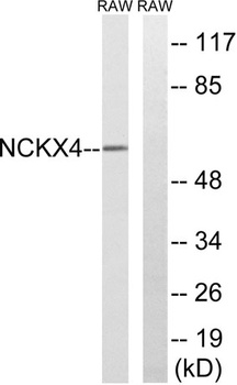 NCKX4 rabbit pAb