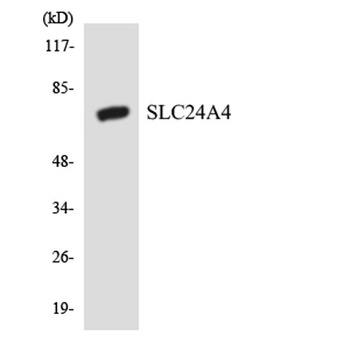 NCKX4 antibody