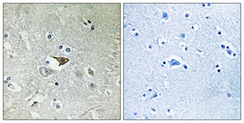 CKR-5 rabbit pAb