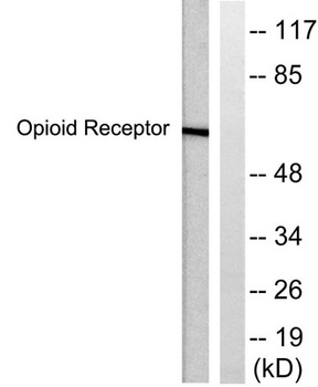 CKR-5 antibody