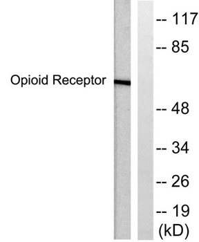 CKR-5 rabbit pAb