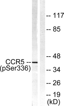 CKR-5 (phospho-Ser336) antibody