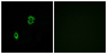 CKR-7 antibody