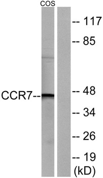 CKR-7 antibody