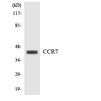 CKR-7 antibody