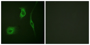 HSP20 (phospho Ser16) rabbit pAb