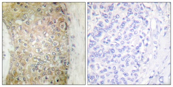 HSP20 rabbit pAb Antibody