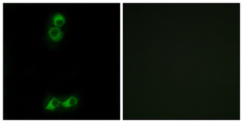 Olfactory receptor 10J5 rabbit pAb Antibody