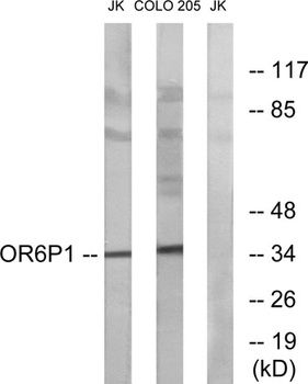 Olfactory receptor 6P1 rabbit pAb