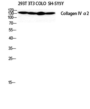 COL4A2 rabbit pAb
