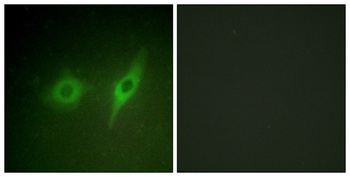 Collagen IV antibody