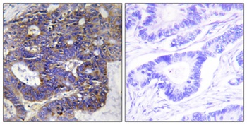 Collagen IV antibody