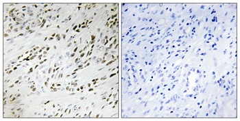 TSHZ2 antibody