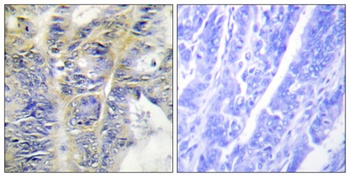 Collagen IV antibody