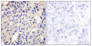 Collagen V antibody