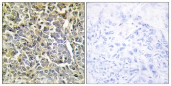 COL6A2 antibody