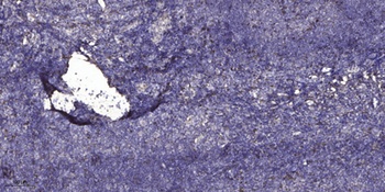 COL9A1 rabbit pAb