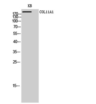 COL11A1 rabbit pAb