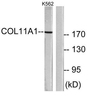 COL11A1 antibody