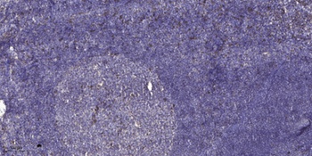 COL11A1 rabbit pAb