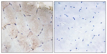 COL12A1 antibody