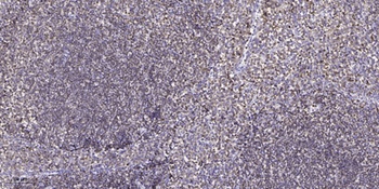 COL17A1 rabbit pAb