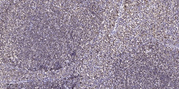 COL17A1 antibody