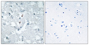 Glycerate Kinase rabbit pAb