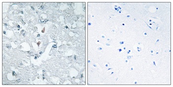 Glycerate Kinase antibody