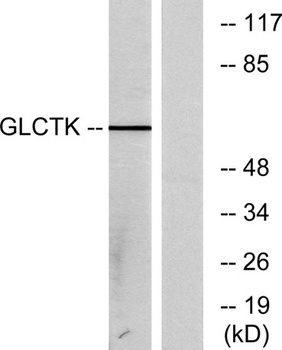 Glycerate Kinase rabbit pAb