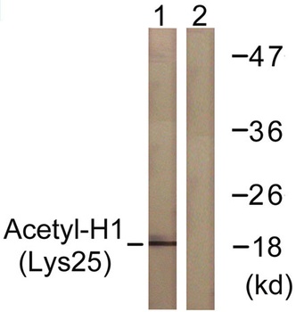 Acetyl Histone H1 (K25) antibody