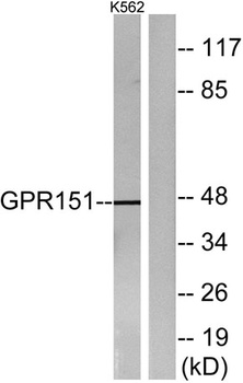 GPR151 rabbit pAb