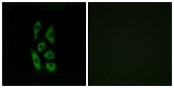 ACOT12 antibody