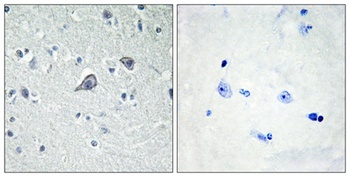 Adenosine A2A-R rabbit pAb