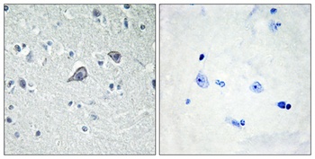 ADORA2A antibody