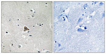 Claudin-4 rabbit pAb