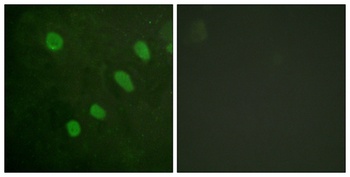 ATF-2 (phospho Ser480) rabbit pAb