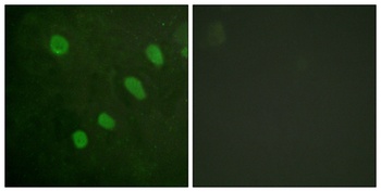 ATF-2 (phospho-Ser480) antibody