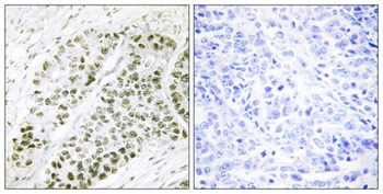 ATF-2 (phospho Ser480) rabbit pAb