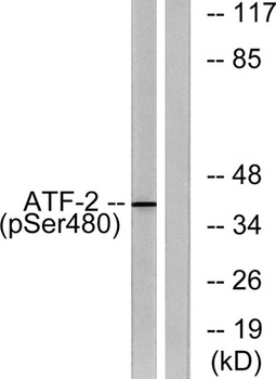 ATF-2 (phospho Ser480) rabbit pAb