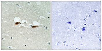 ATF-2 (phospho Ser472) rabbit pAb