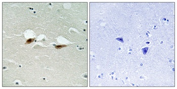 ATF-2 (phospho-Ser472) antibody