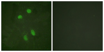 ATF-2 rabbit pAb Antibody