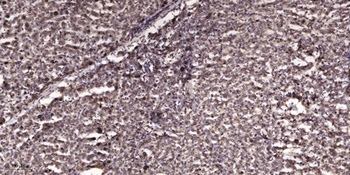 ATF-2 rabbit pAb Antibody